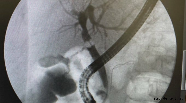 SAĞLIKTA AĞRI'DA BİR İLK