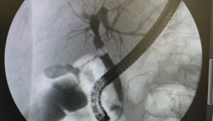 SAĞLIKTA AĞRI'DA BİR İLK