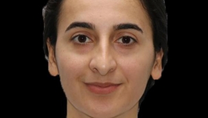 Doğubayazıt'ta görevli Polis Memuru Burcu Ertem, tedavi gördüğü hastanede yaşamını yitirdi.