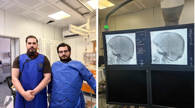 Ağrı'da İlk Beyin Anjiyografisi Başarıyla Gerçekleştirildi